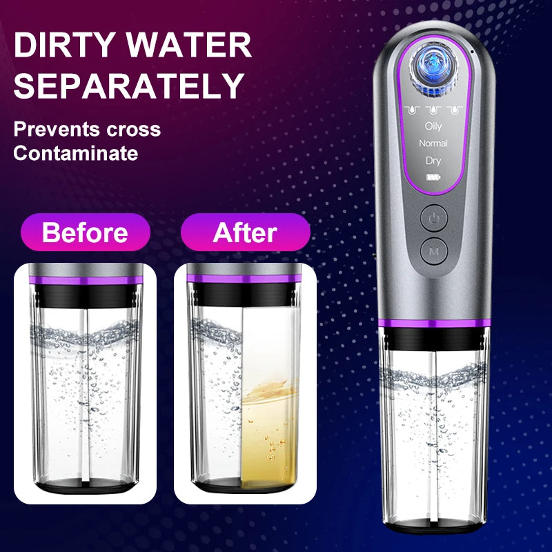 Professional 6 Suction Heads Facial Pore Blackhead Remover Vacuum - Face Cleaner and Blackhead Extractor for All Skin Types